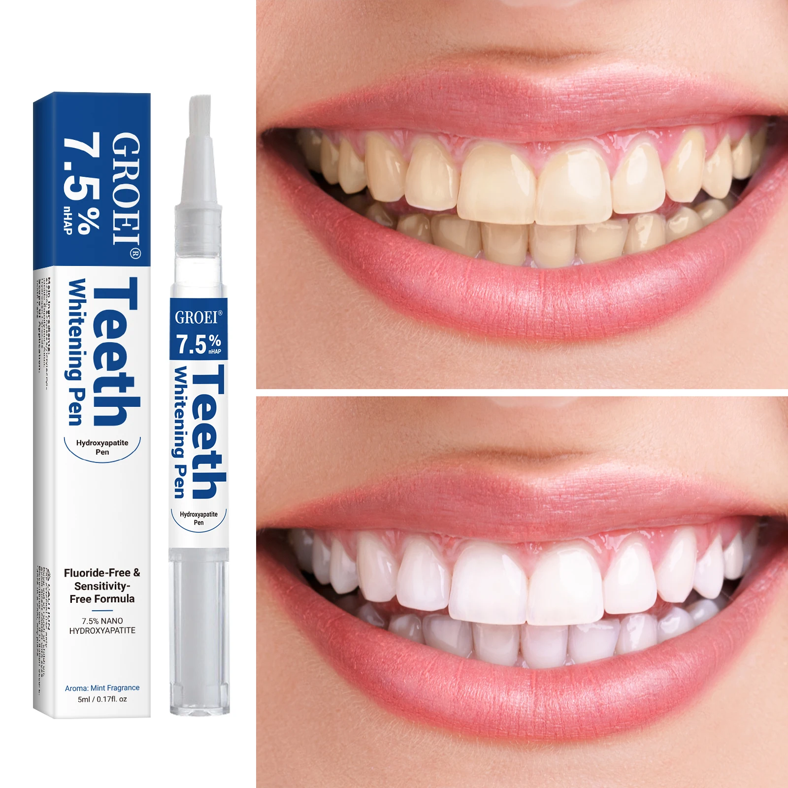 Stylo de blanchiment des dents - Teeth Whitening Pens avis et prix