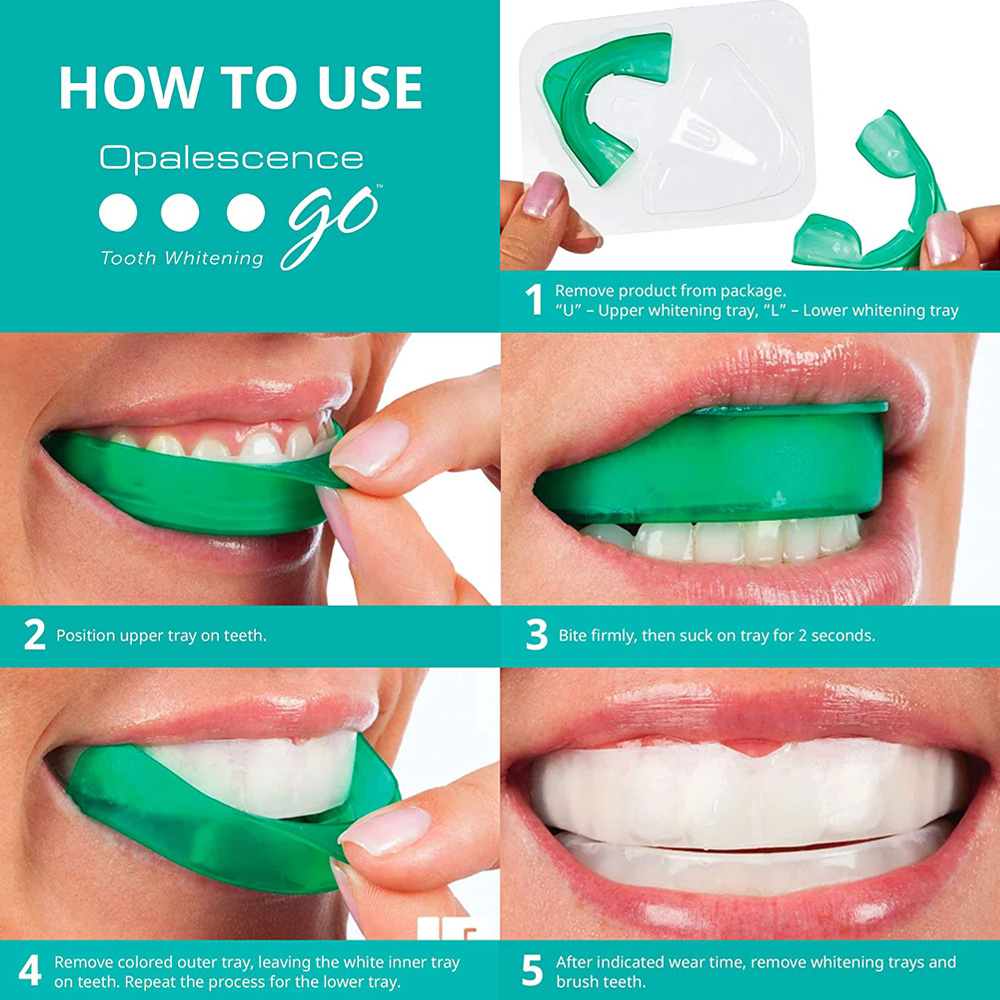 Opalsagesse Go-Bacs préremplis - Teeth Whitening At Home avis et prix