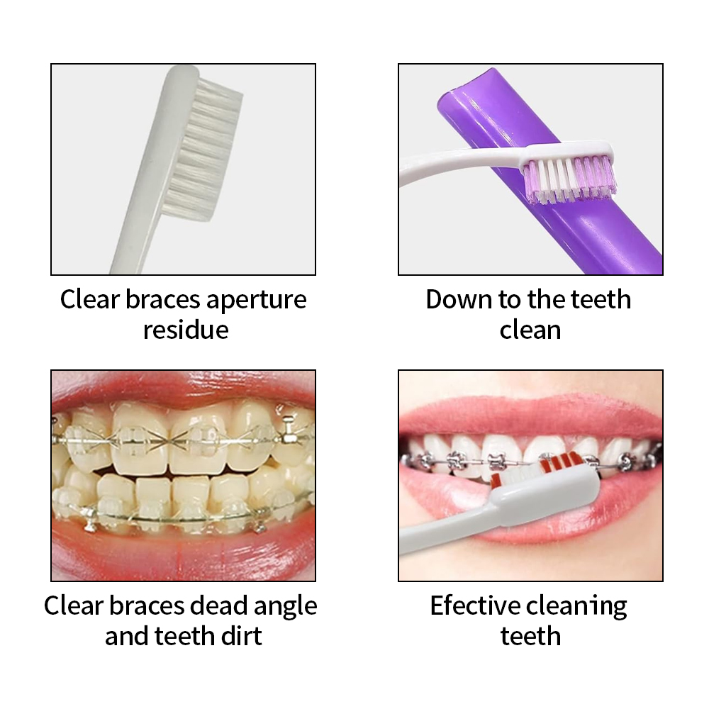 Kit de brosses de soins dentai - Teeth Whitening For Braces avis et prix