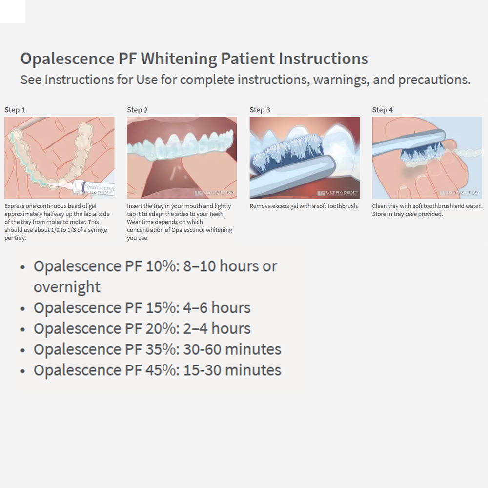 Opalwisdom-Kit de Blanchiment  - Teeth Whitening Results avis et prix