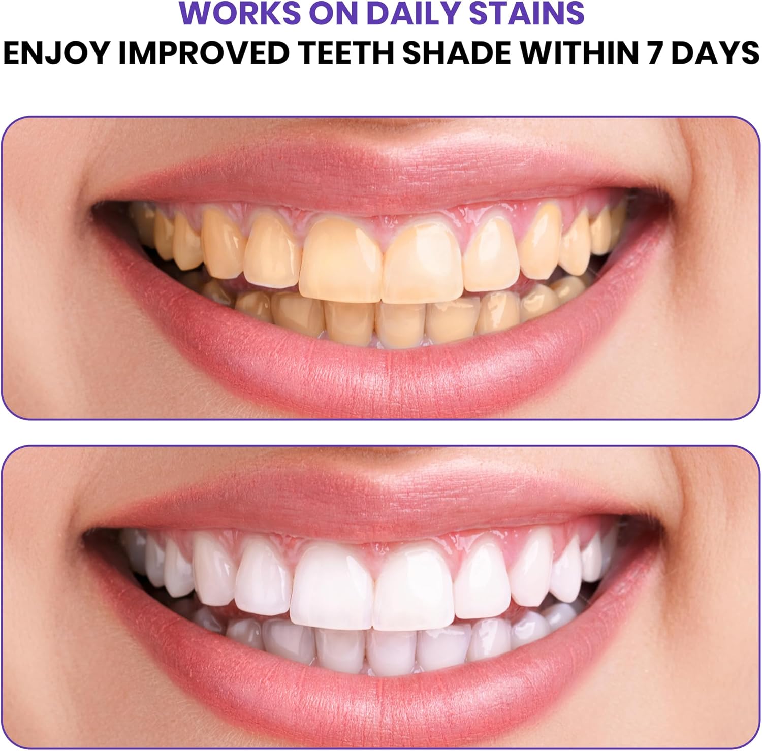 Bandes blanchissantes violette - Teeth Whitening At Home avis et prix