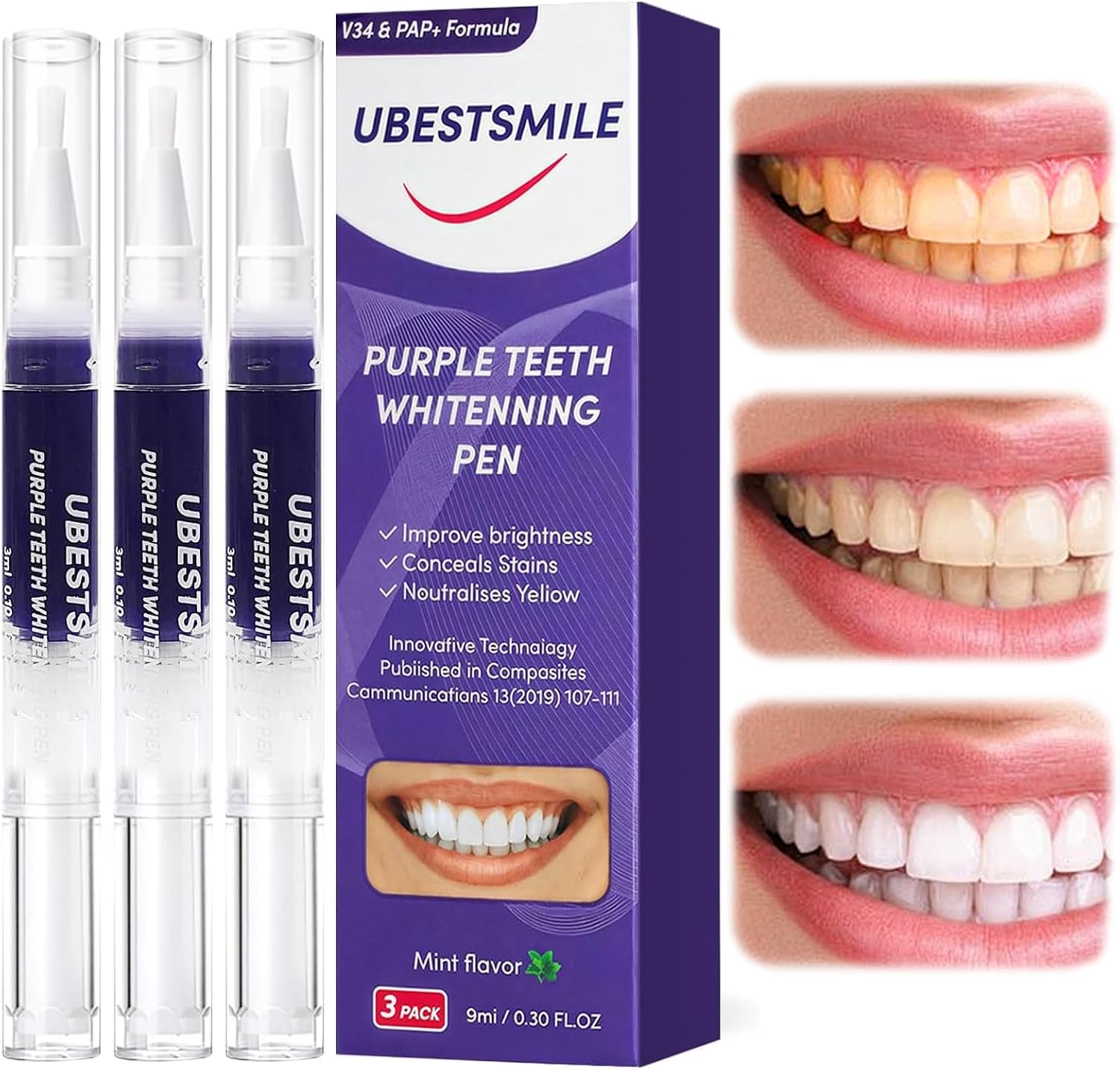 UBESTSMILE V34&PAP+ Formula Pu - Teeth Whitening Pens avis et prix