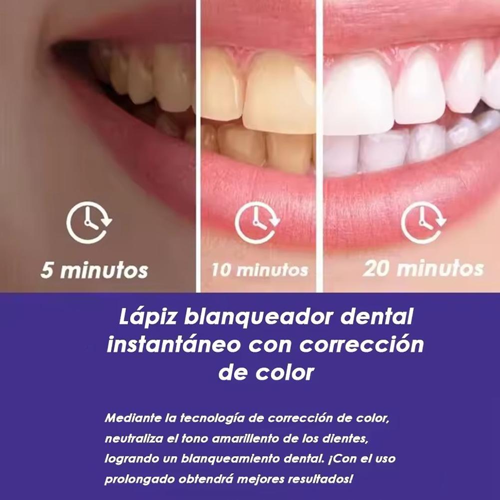 UBESTSMILE V34&PAP+ Formula Pu - Teeth Whitening Pens avis et prix