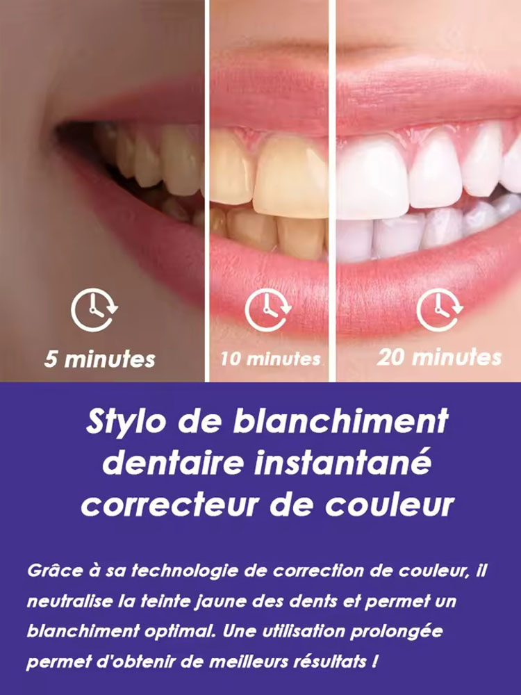 Lot de 2 stylos blanchissants  - Teeth Whitening Pens avis et prix