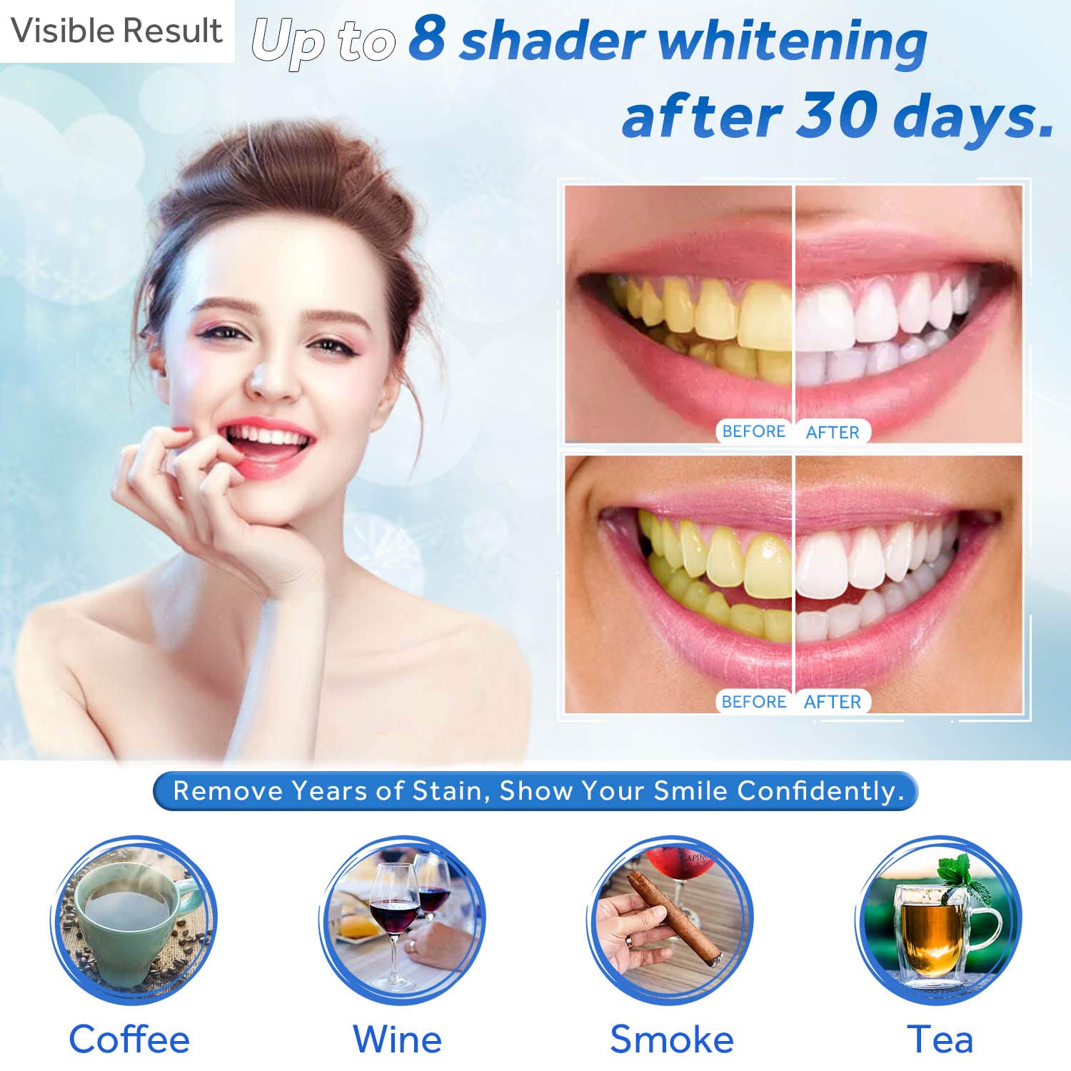 Gel de blanchiment des dents r - Teeth Whitening Results avis et prix