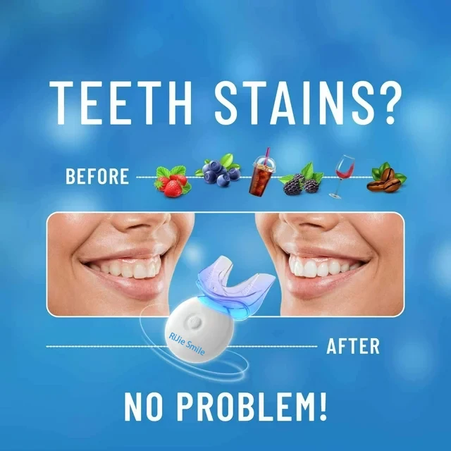 Kit de blanchiment dentaire sa - Teeth Whitening At Home avis et prix