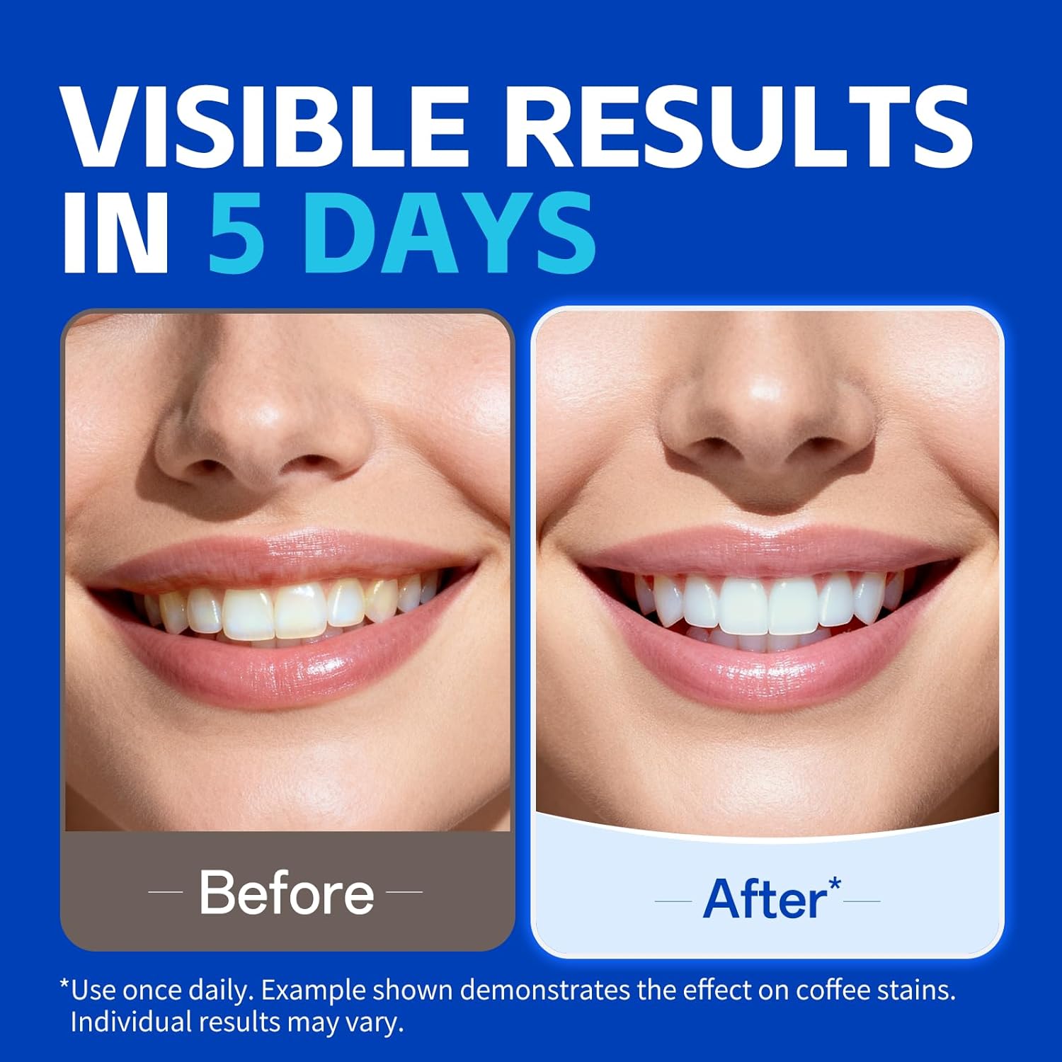 1/7 paires de bandes blanchiss - Teeth Whitening Street avis et prix
