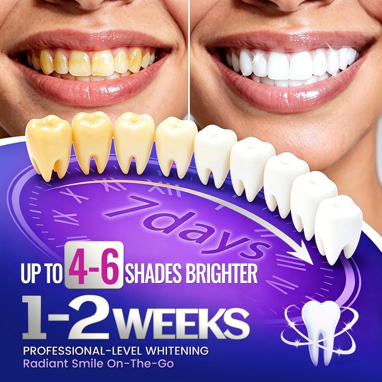 1/7 paires de bandes blanchiss - Teeth Whitening Street avis et prix