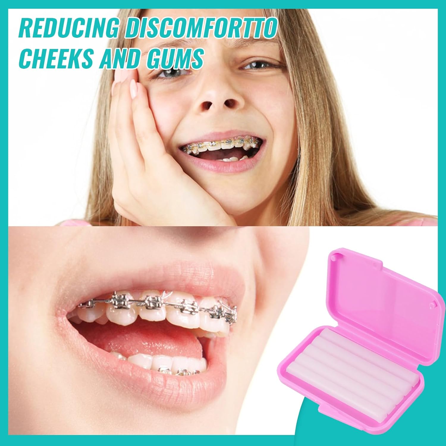10 boîtes de cire de soulageme - Teeth Whitening For Braces avis et prix