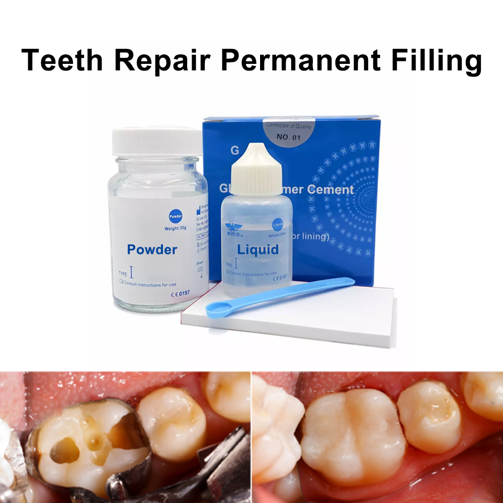 Kit de réparation de remplissa - Teeth Whitening At Home avis et prix