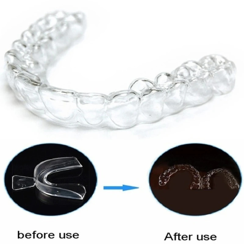Protège-dents Anti-ronflement, - Dental Guard Night avis et prix