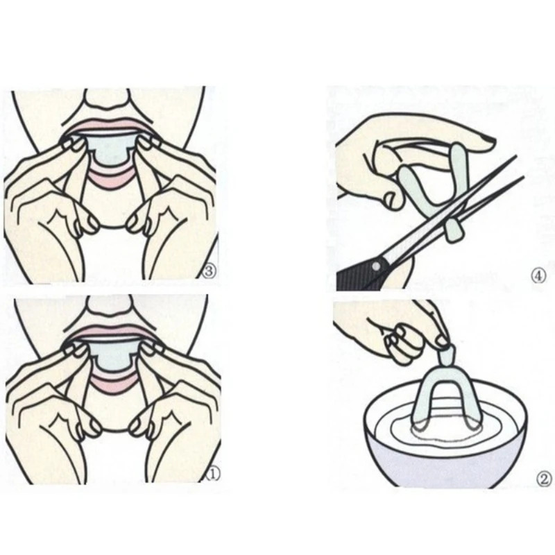 Protège-dents Anti-ronflement, - Dental Guard Night avis et prix