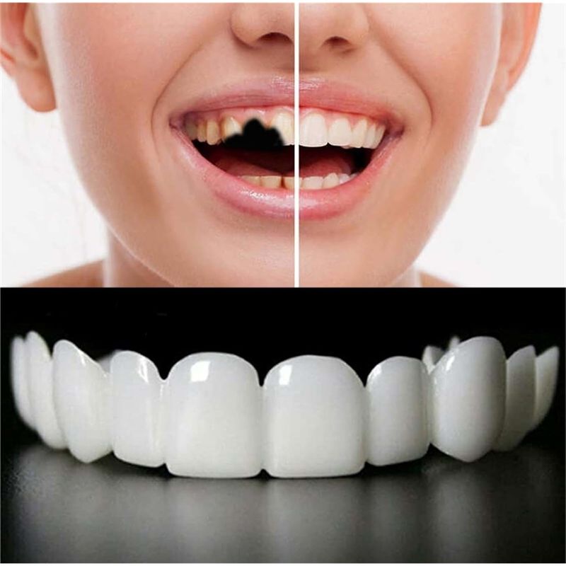 [NOUVEAU! ABMK] 2 paires, redo - Teeth Whitening For Braces avis et prix