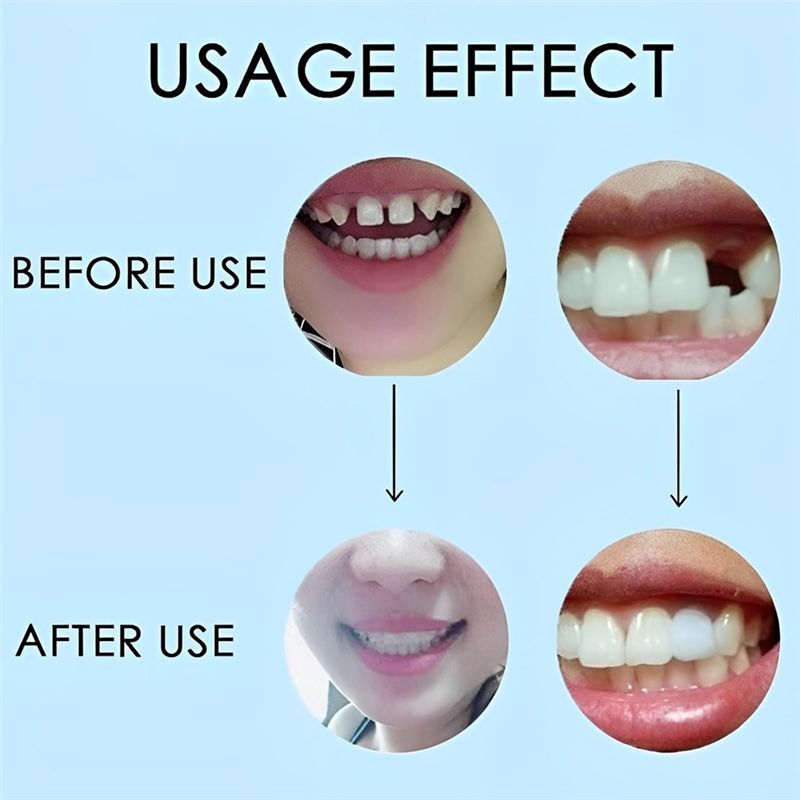 [NOUVEAU! ABMK] 2 paires, redo - Teeth Whitening For Braces avis et prix